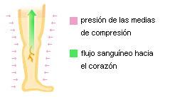 Volar cometa Debe Típico Sí, las medias de compresión pueden ayudar a prevenir las varices -  Farmaceuticonline