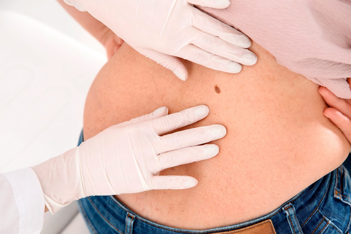 Les-berrugues Les-berrugues