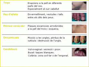 micosis