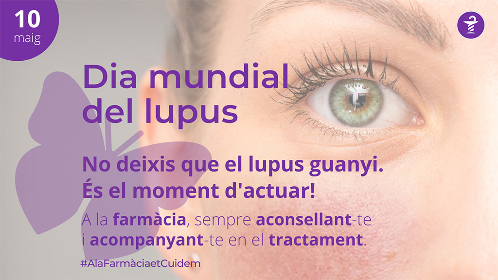 Lupus